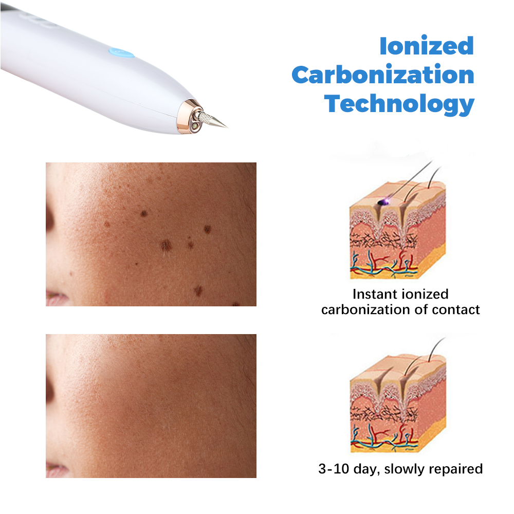Beauty Spot Pen with 9 Adjusta - đánh giá và giá Power Z Tools